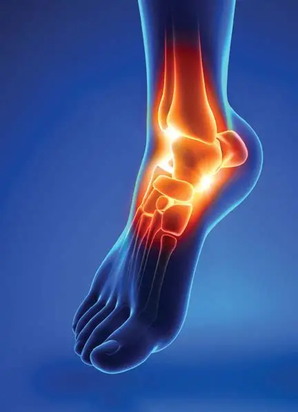 Ankle Pain