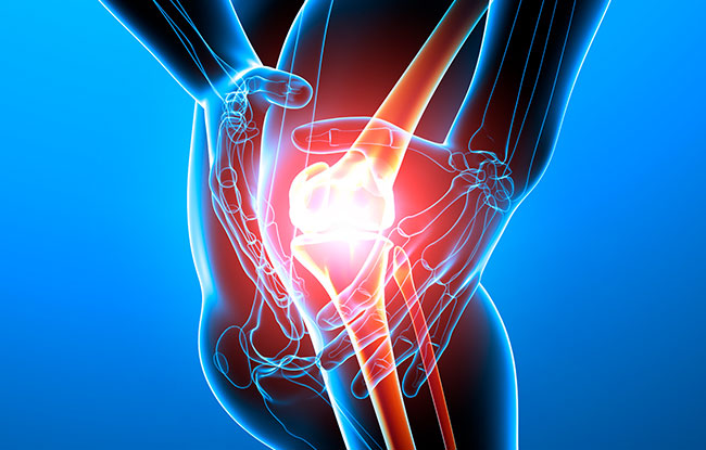 Knee Pain